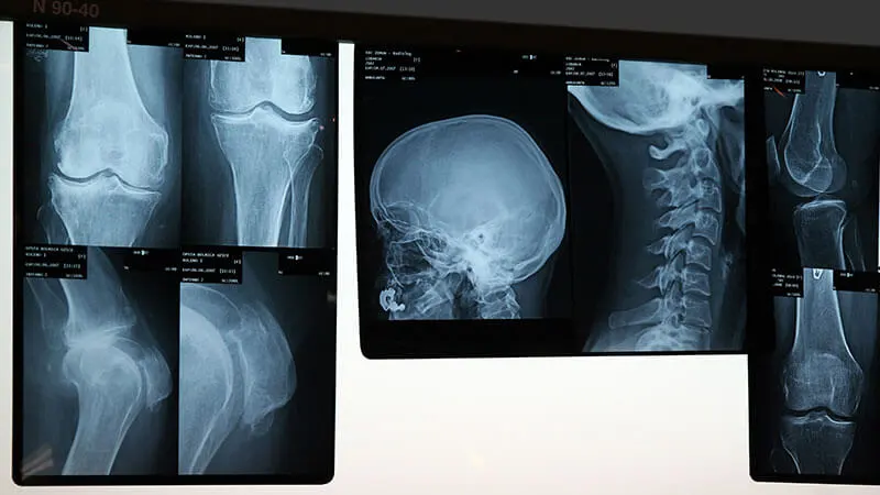 X-ray, ultra-sound and fluoroscopy rooms